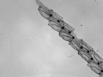 Plankton-Chain